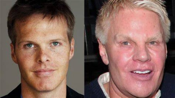 
Has Mike Jeffries had surgery to change his looks 